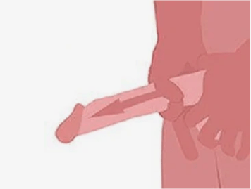 Gelling method
